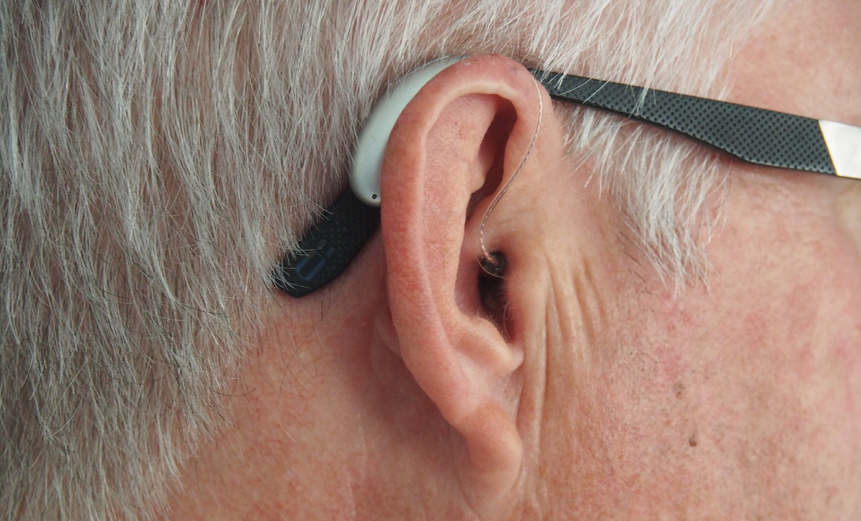 Consumers Should Be Aware of Drawbacks of Over-the-Counter Hearing