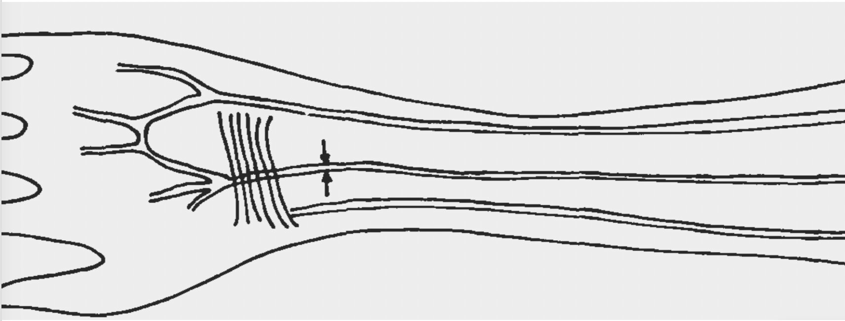 Forearm artery reveals humans evolving from changes in natural selection