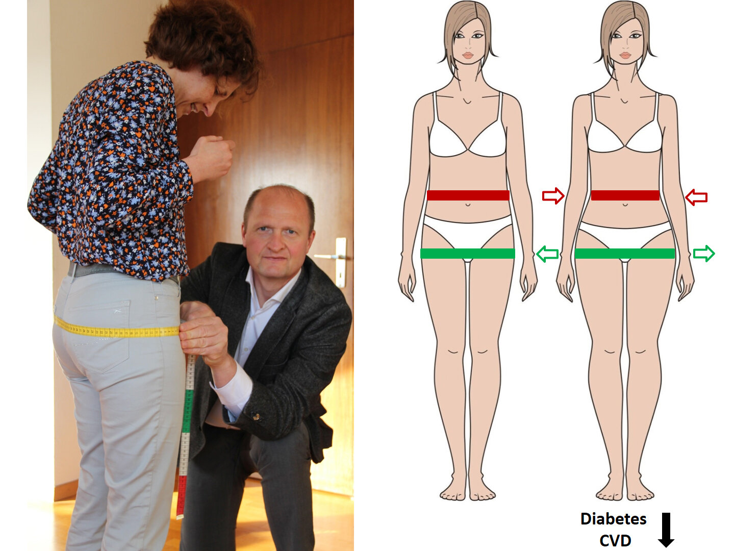 Why a large hip circumference protects from type 2 diabetes and  cardiovascular disease