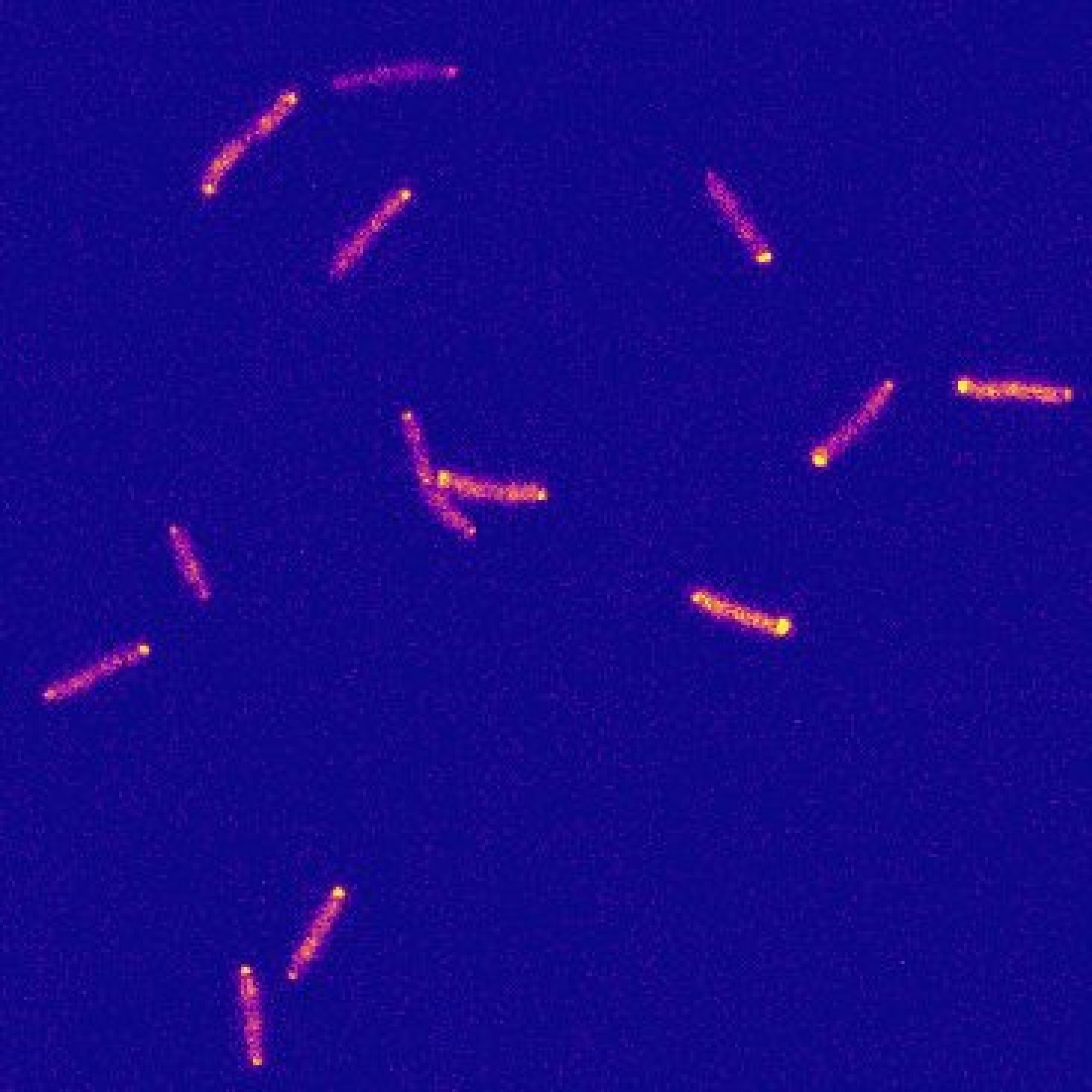 Как перемещаются бактерии. Бактерии перемещаются по венам. Pillars of bacteria IV Type.