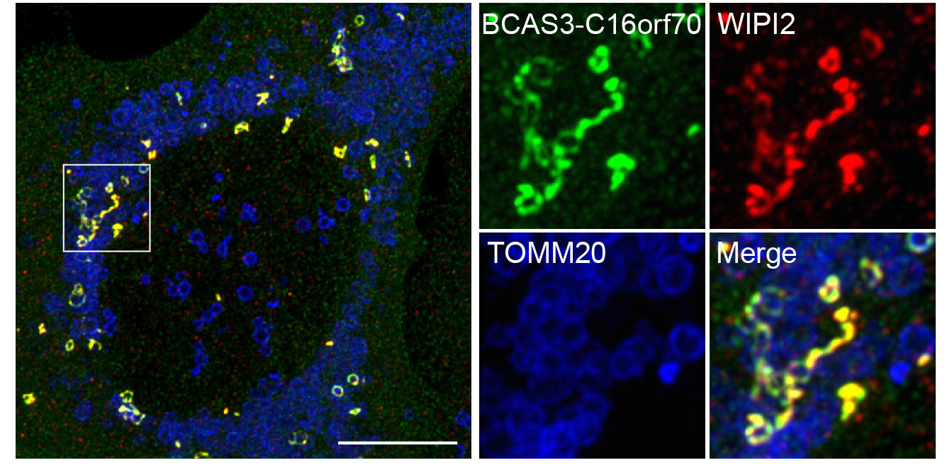 photo of BCAS3-C16orf70 complex is a new actor on the mammalian autophagic machinery image