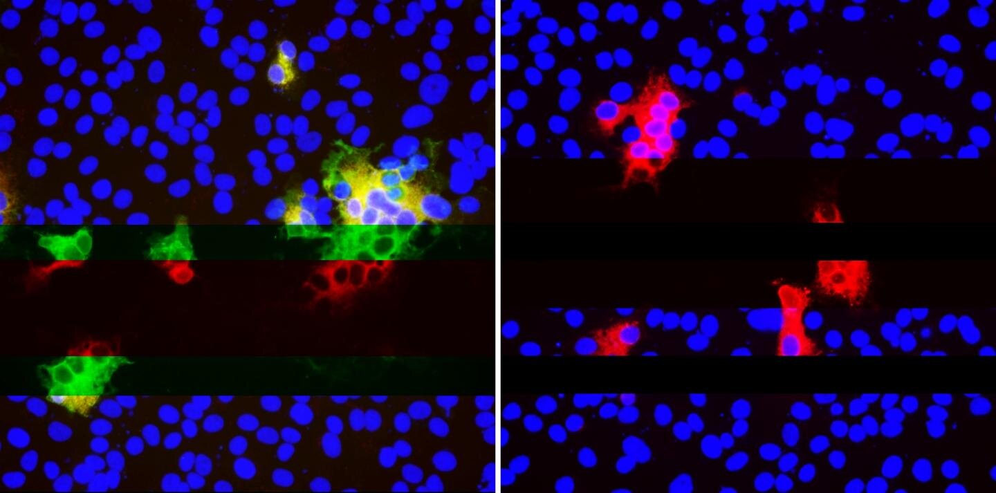 How SARS-CoV-2 mutates to escape antibody binding