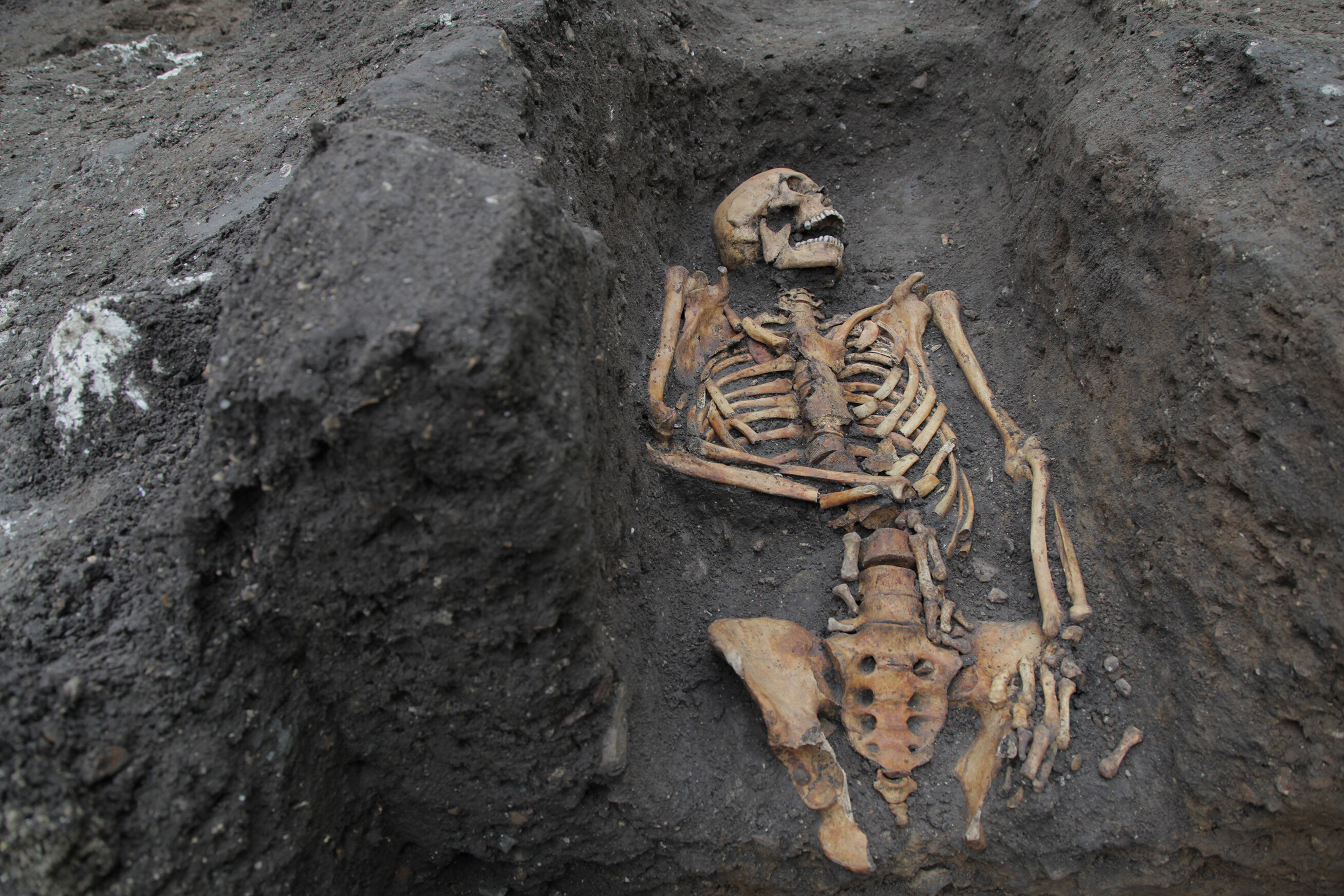 Inequality in medieval Cambridge was “recorded in the bones” of its residents