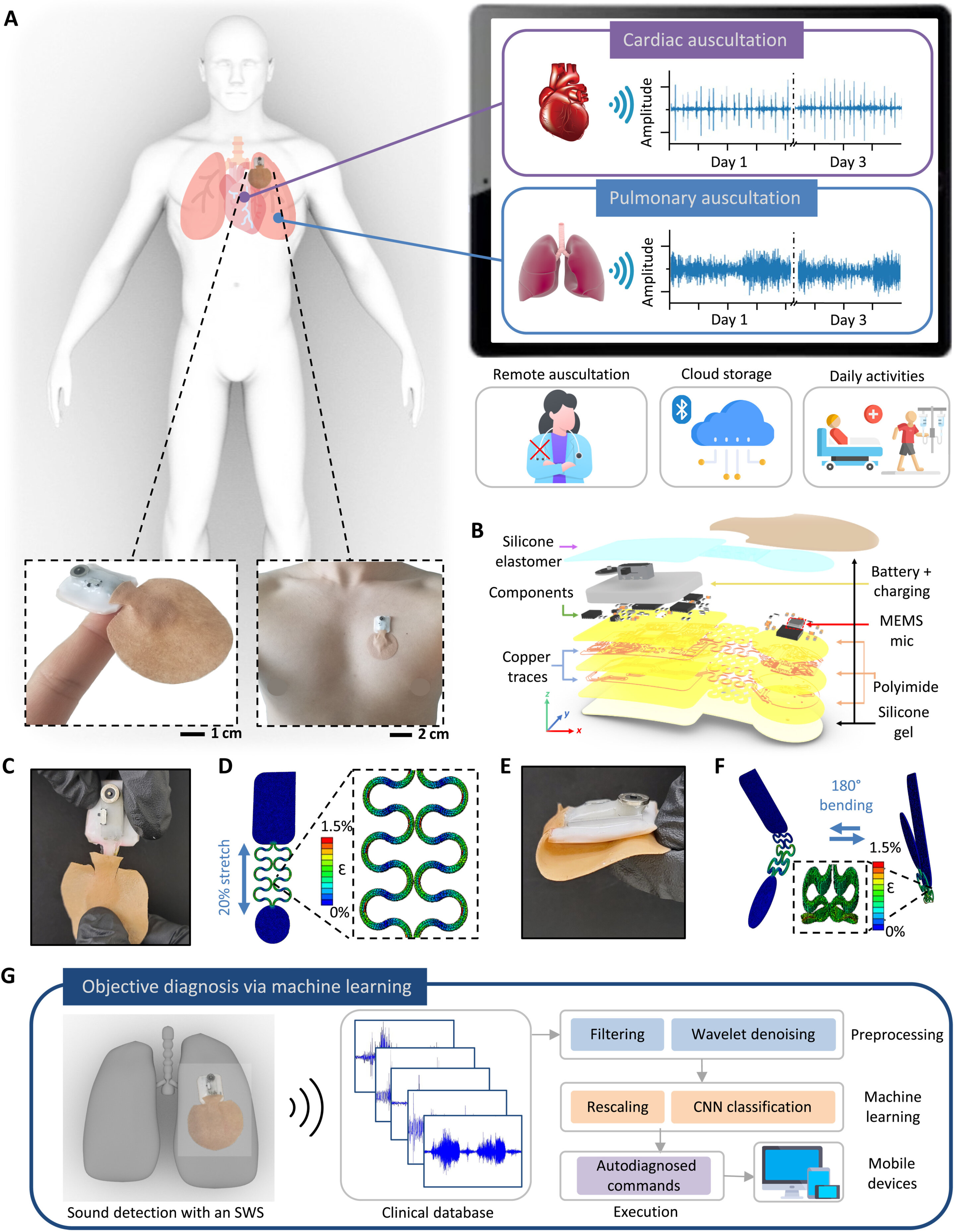 #A soft wearable stethoscope designed for automated remote disease diagnosis