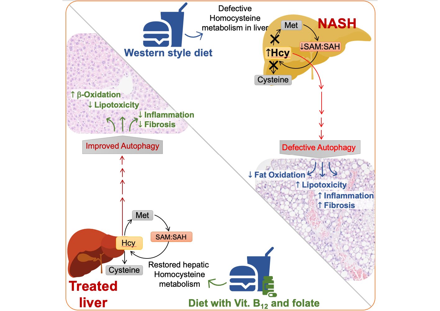 B potentially be used to treat advanced non-alcoholic fatty liver