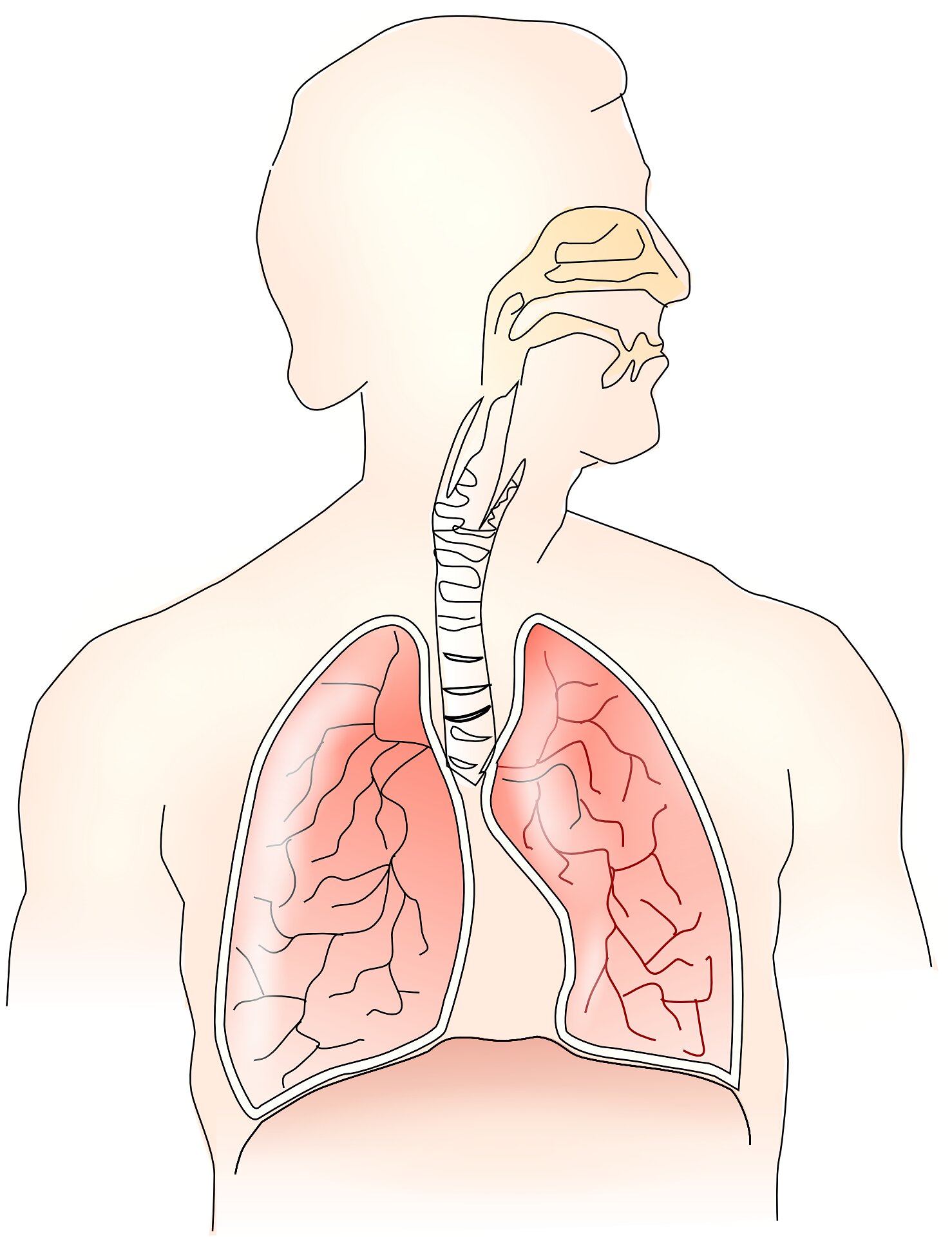 Exhaled breath analysis shows promise in detecting malignant pleural mesothelioma