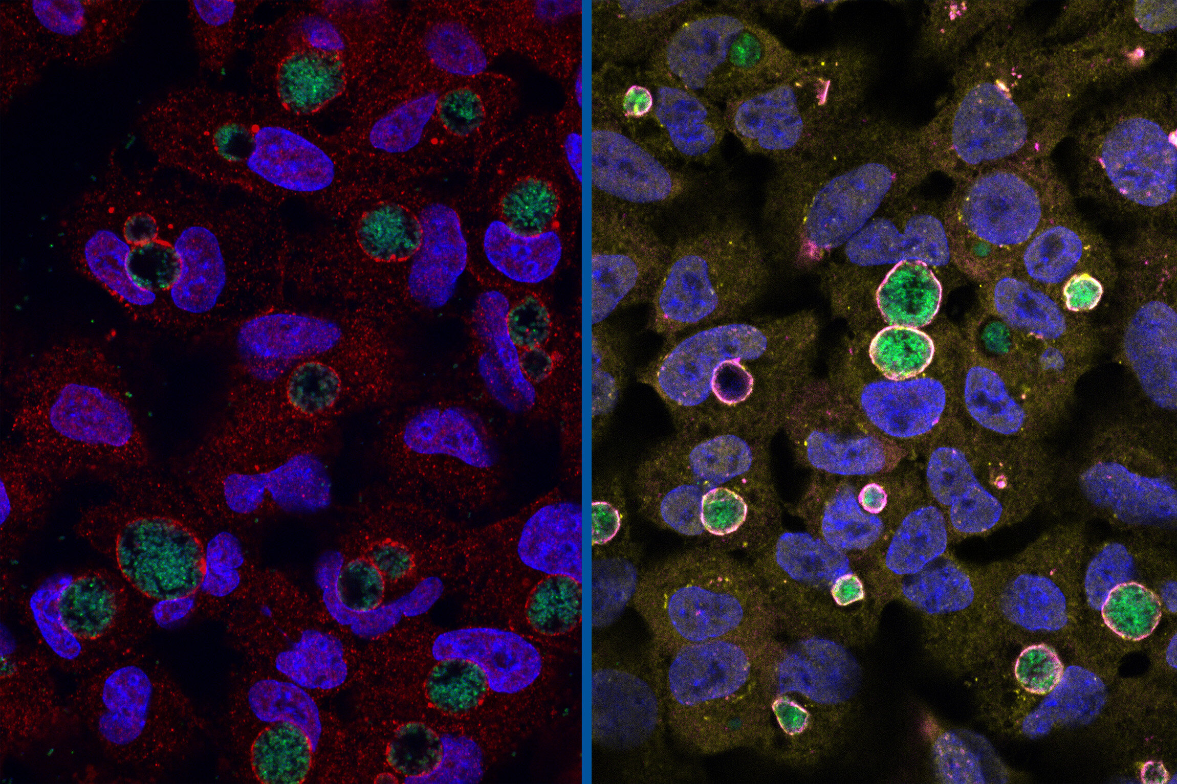 Хламидии 4. Хламидии внутри клетки. Зеленые и пурпурные бактерии.