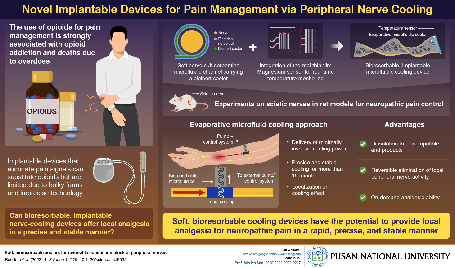 Next-gen Device Could Relieve Phantom Limb Pain
