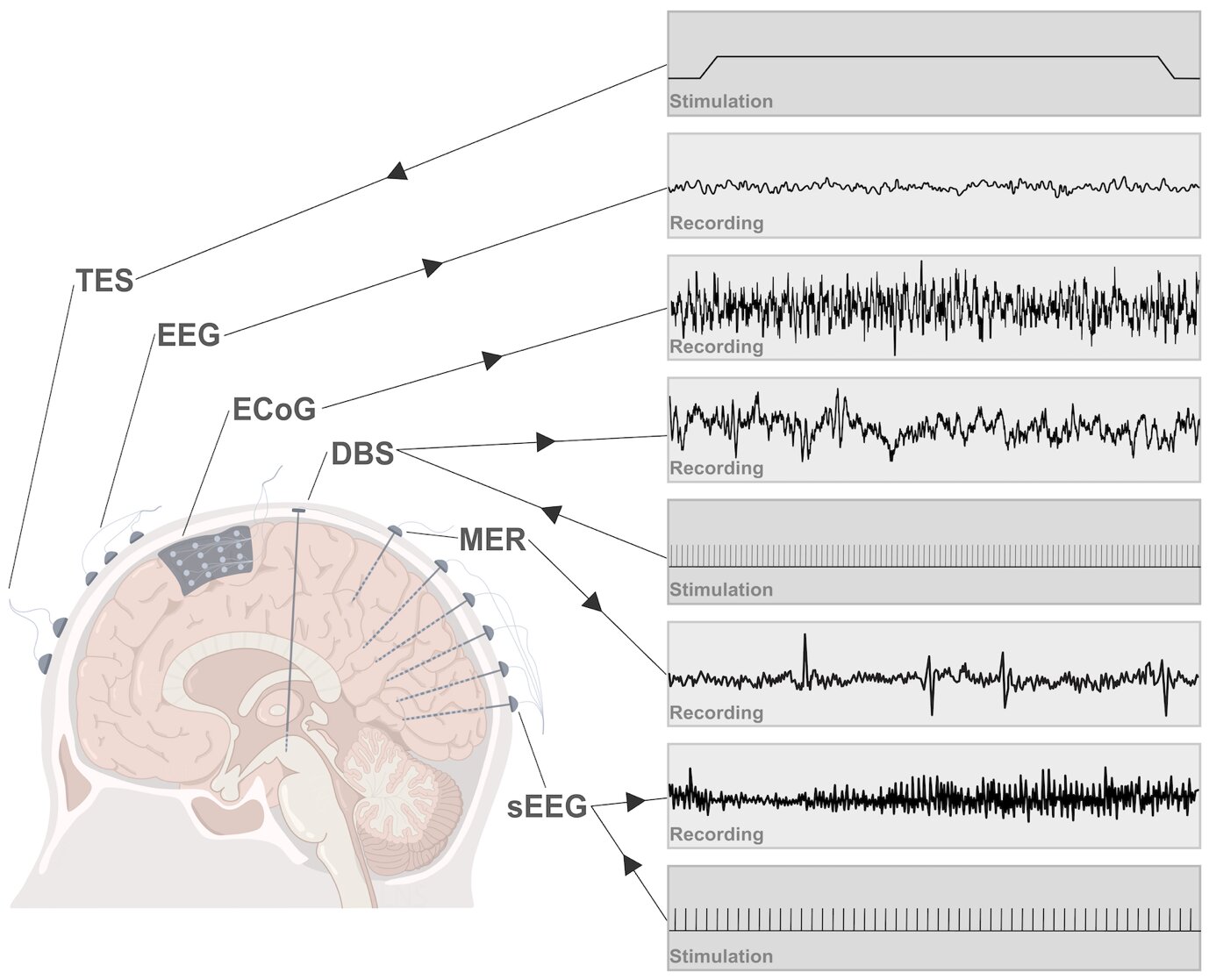 #Sensing and modulating the human deep brain