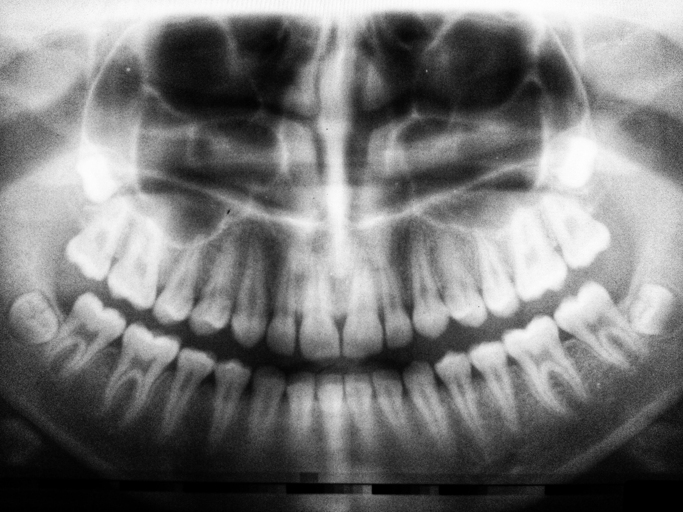 Ai Identifies Biological Sex Using Dental X Rays