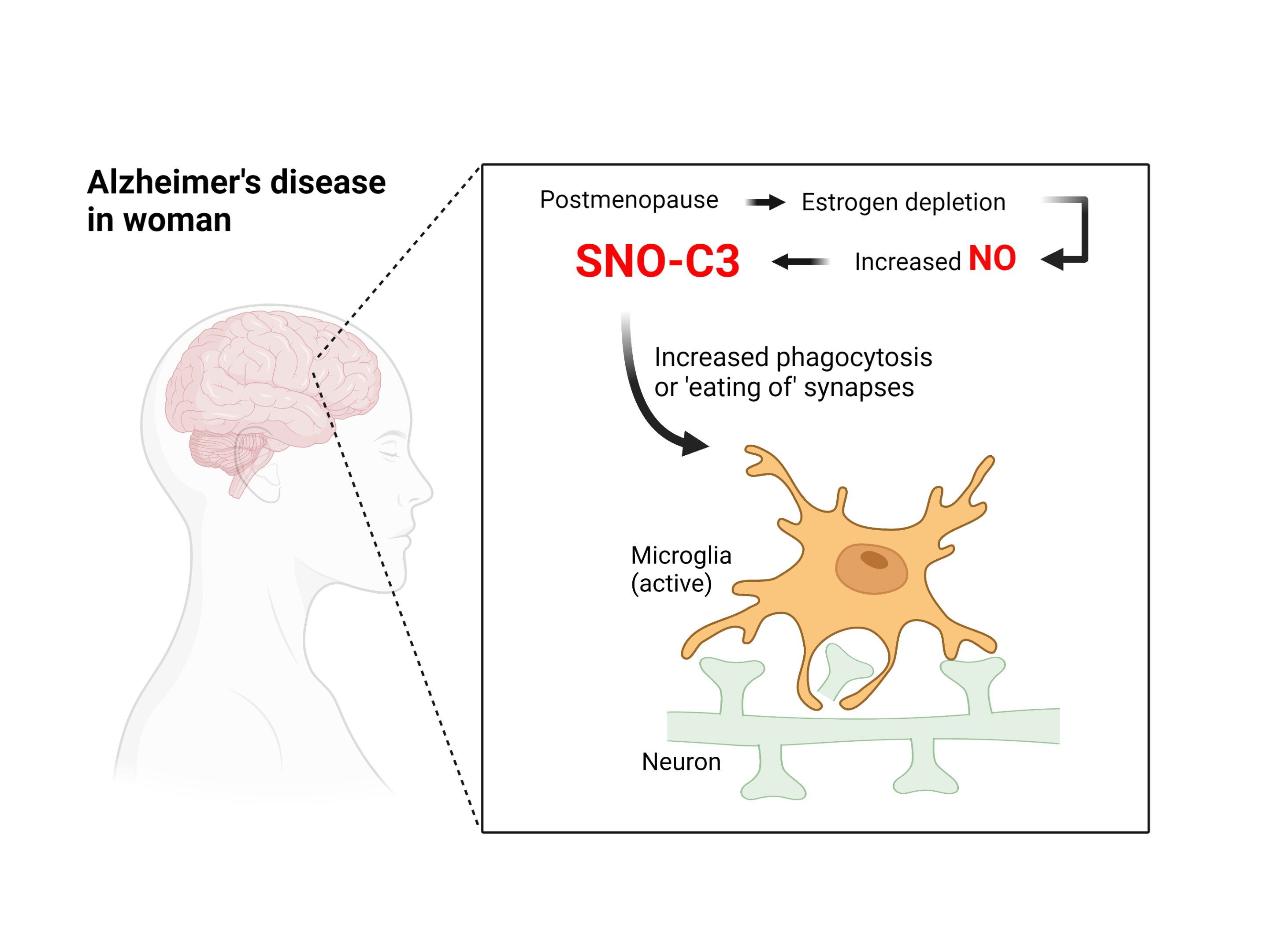 Всемогущий эстроген: учёные объясняют причину высокого риска болезни Альцгеймера у женщин