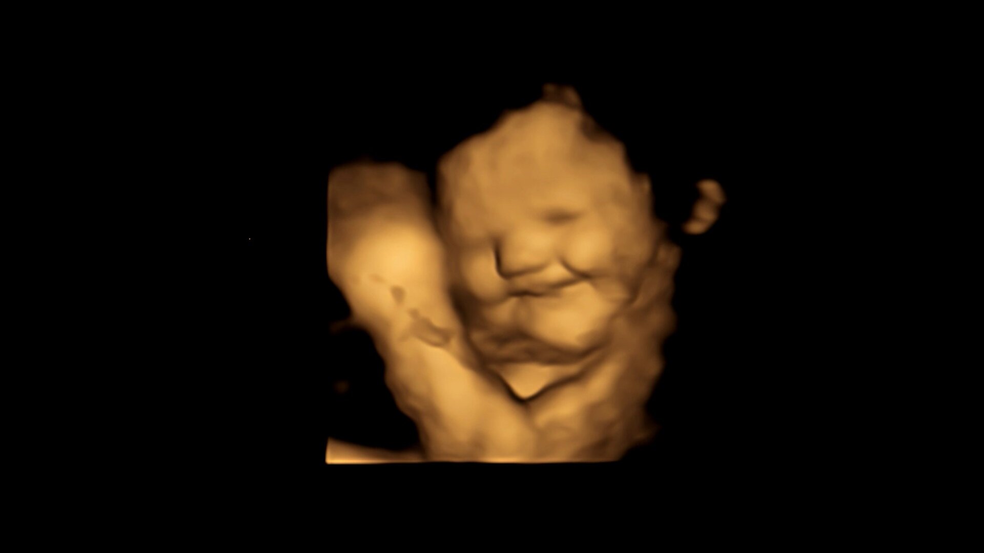 First direct evidence that babies react to taste and smell in the womb