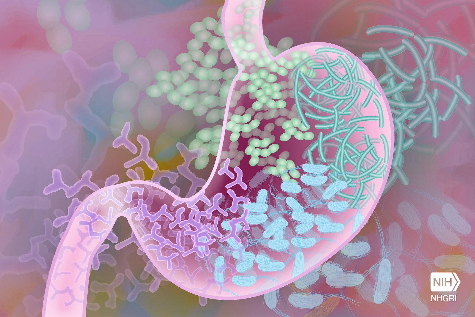 Certain gut conditions may be early warning signs of Parkinson’s disease