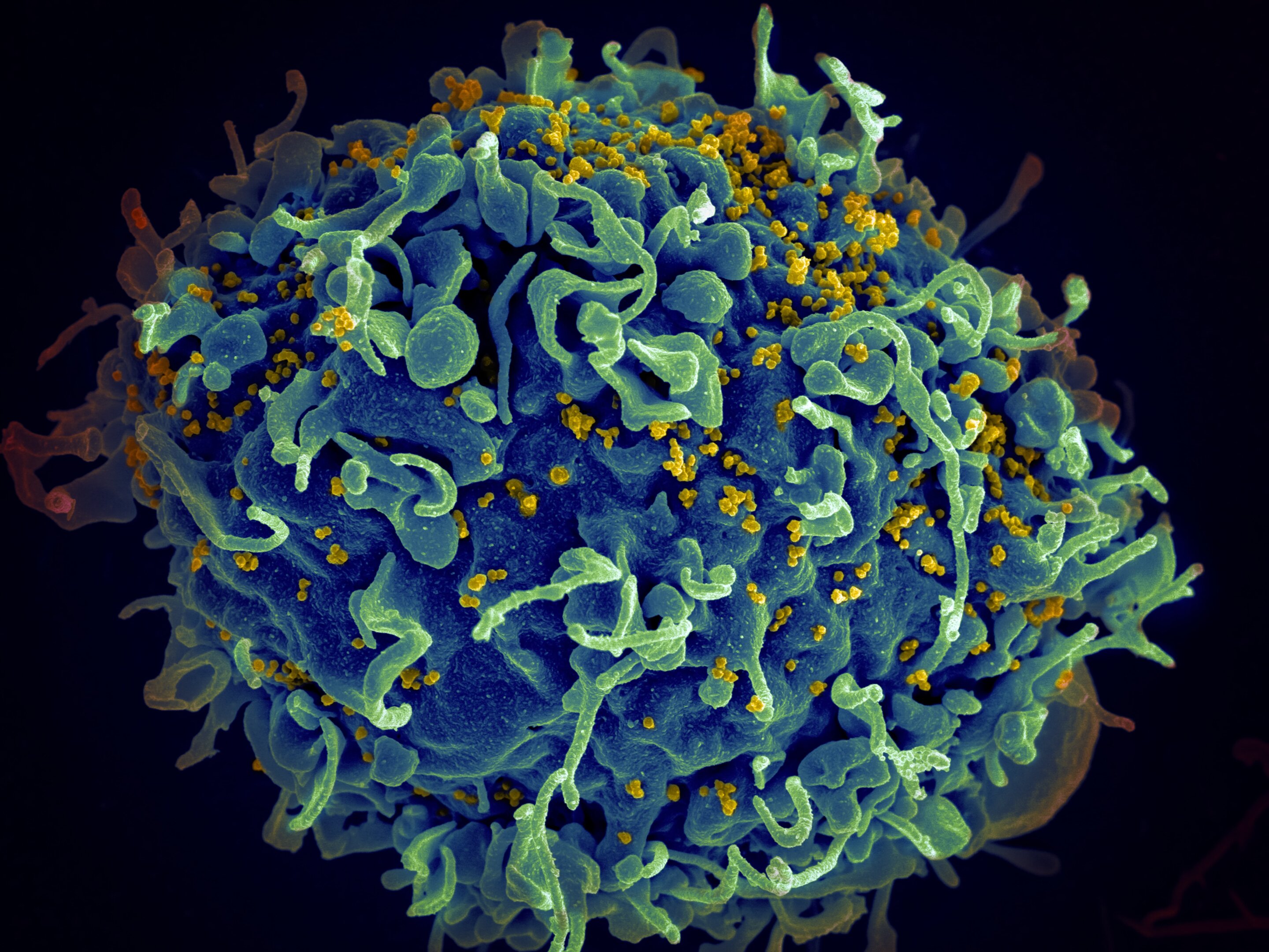Scientists Find Potential Cellular Target For HIV Therapies