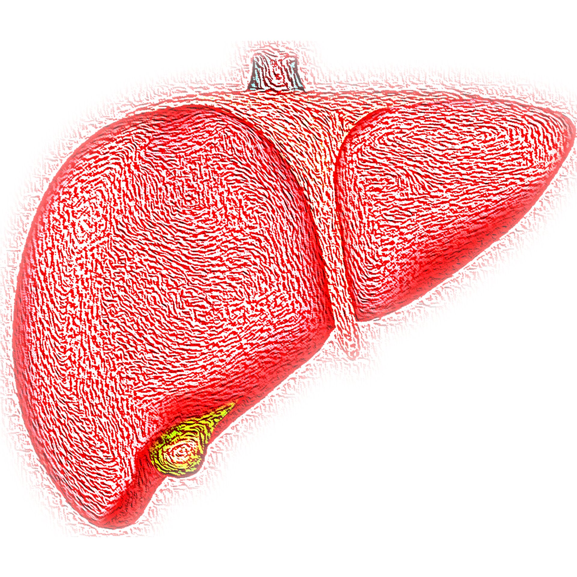 Study: ChatGPT has potential to help cirrhosis, liver cancer patients - current events in healthcare 2022 - Health - Public News Time