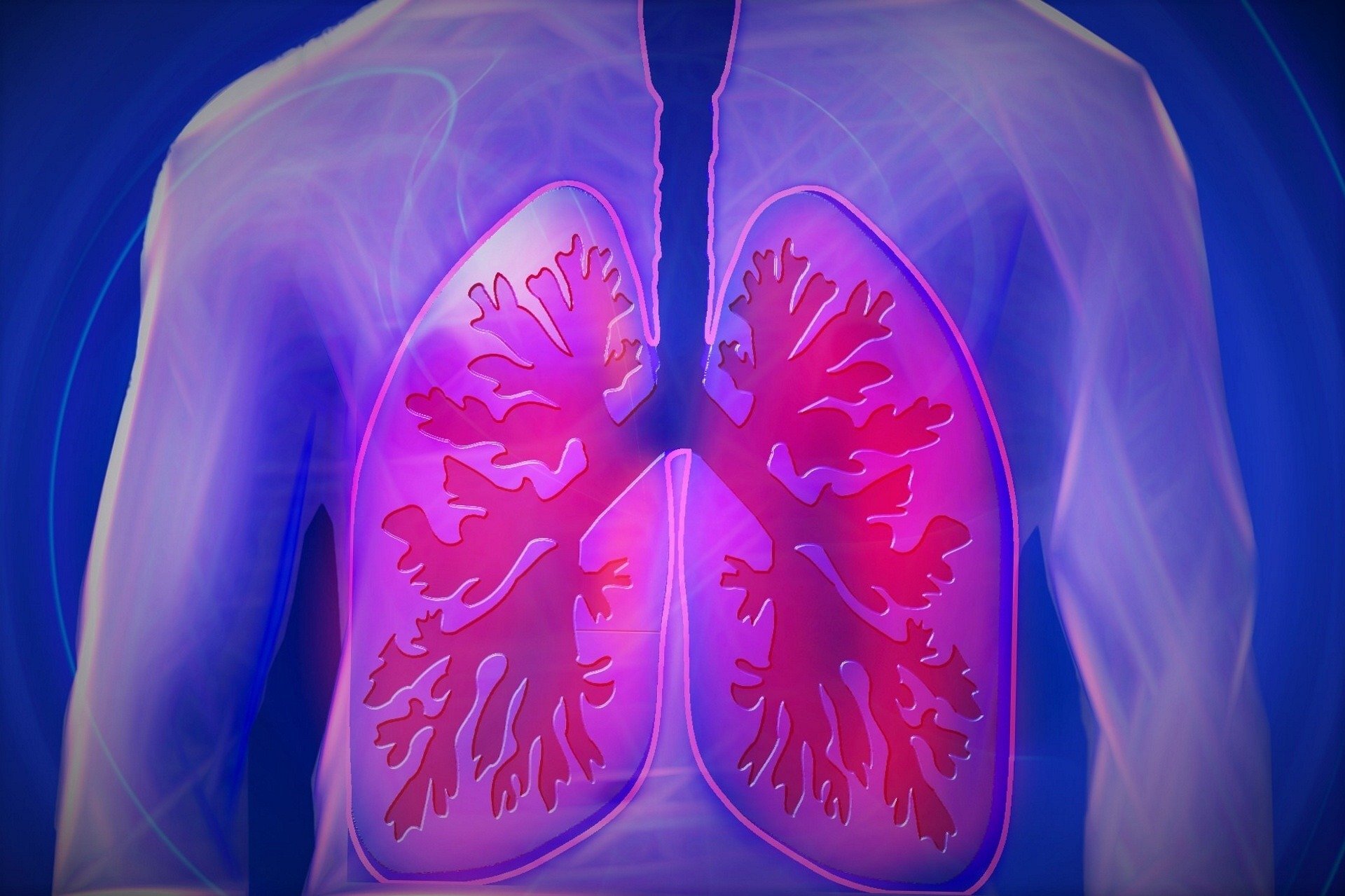 Researchers suggest air pollution be included as risk factor for patients with lung cancer and have never smoked