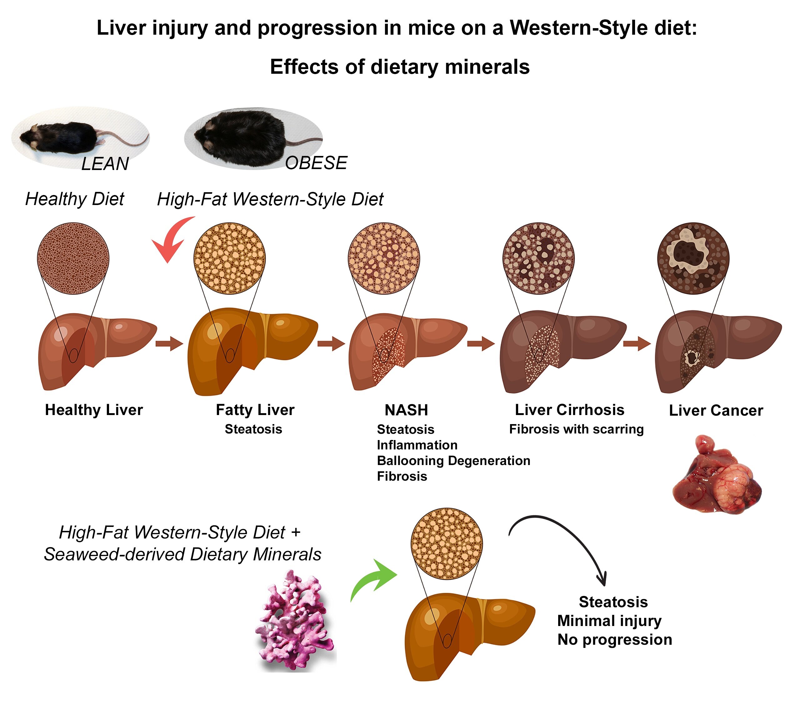 Mineral supplement could stop fatty liver disease progression