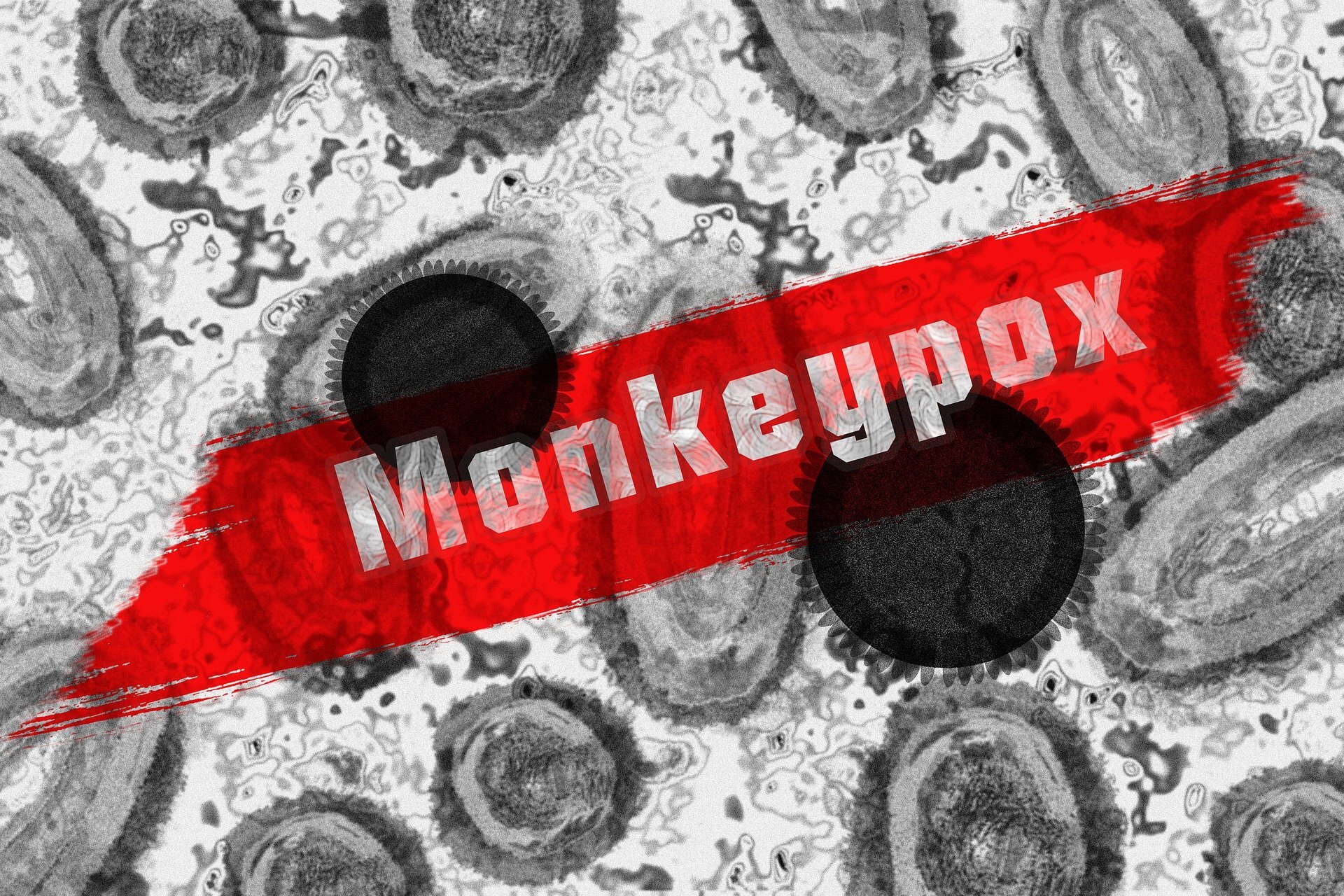 Monkeypox is now a national public health emergency in the US. An epidemiologist explains what this means