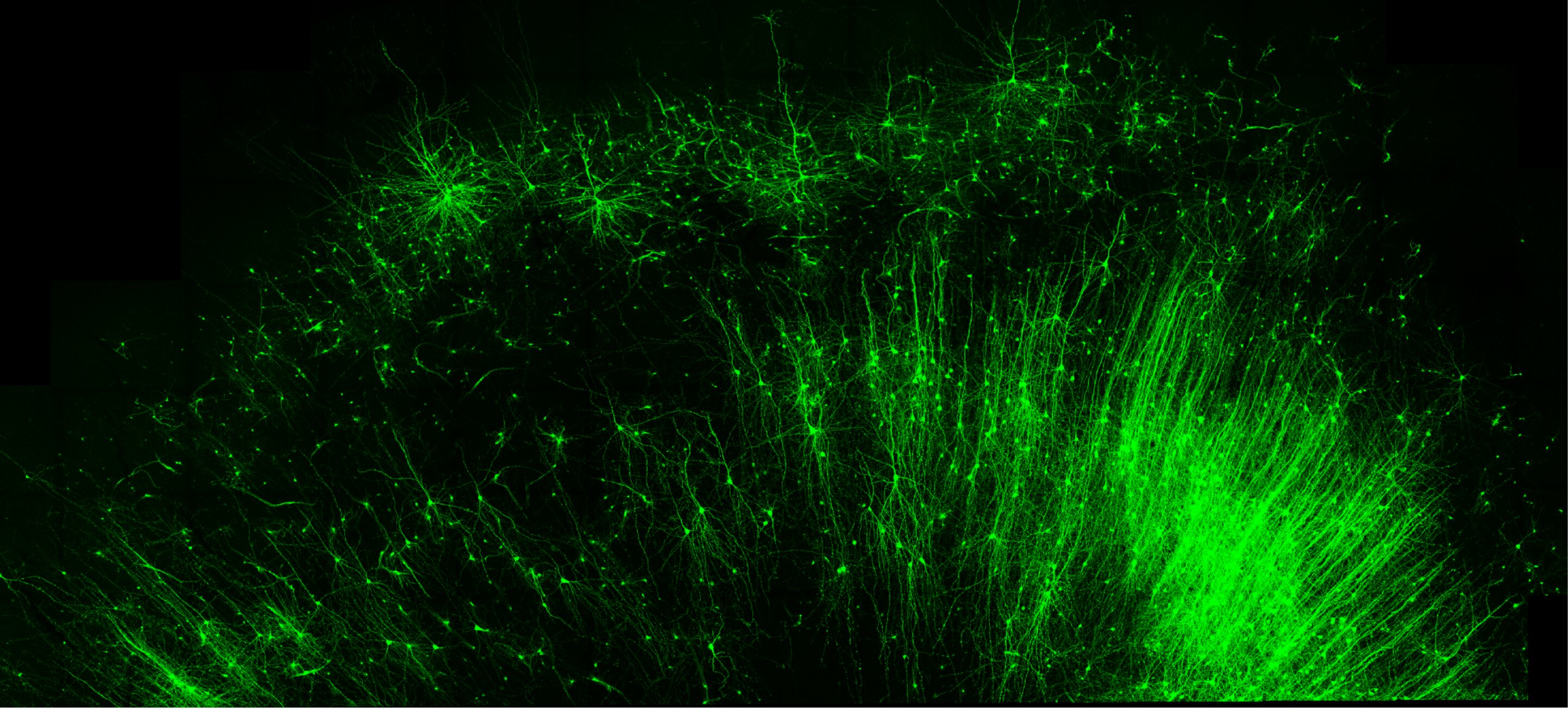 New RNA-based tool can illuminate brain circuits, edit specific cells