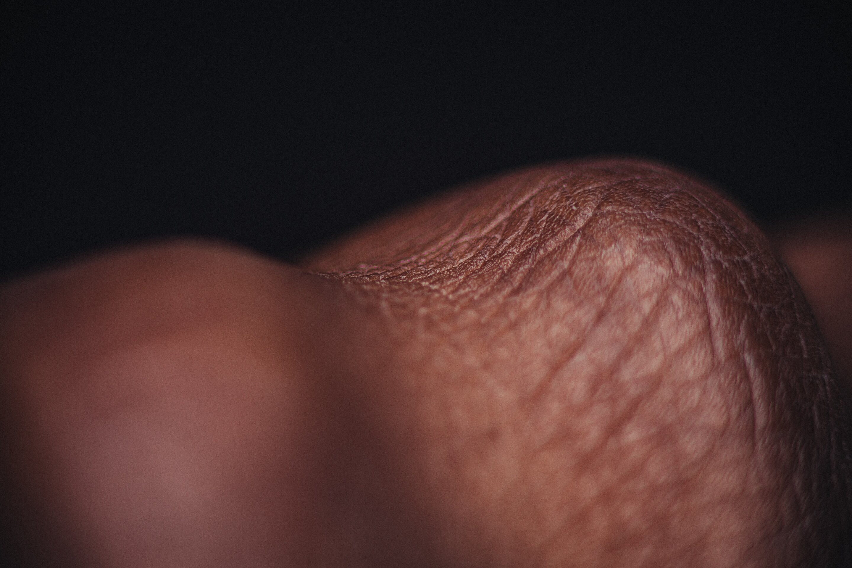 Can artificial skin go beyond the sensing features of natural skin?