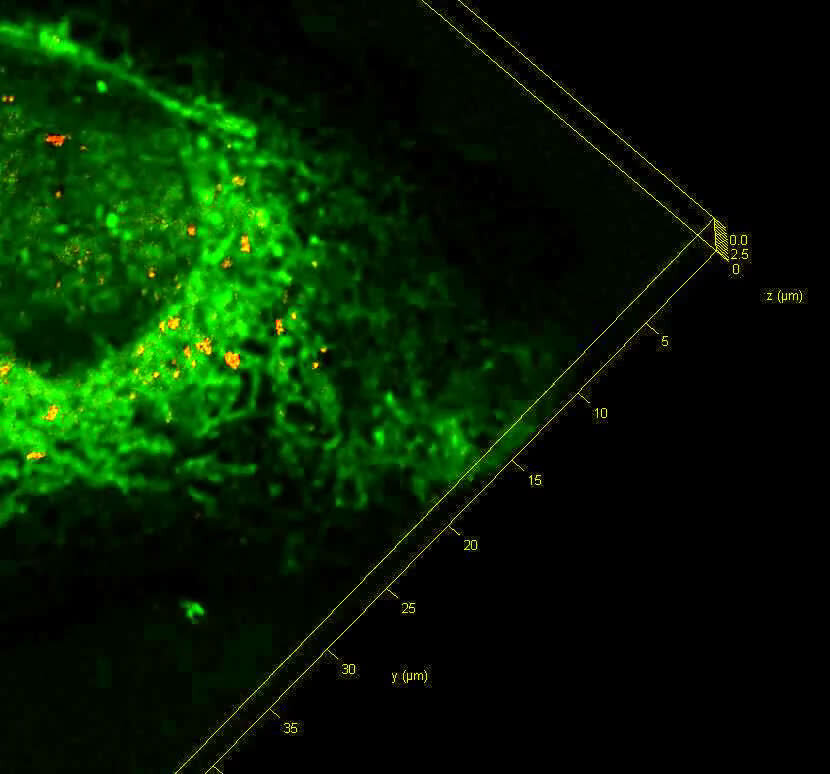 Токсичный белок. Атомно силовая микроскопия флуоресценция картинки.