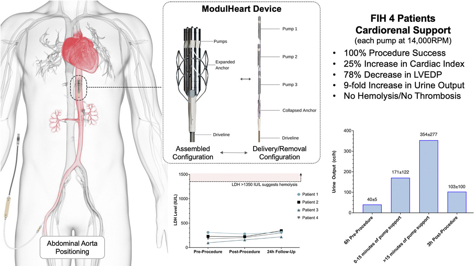 #Study finds mechanical circulatory support and renal perfusion success with the ModulHeart device