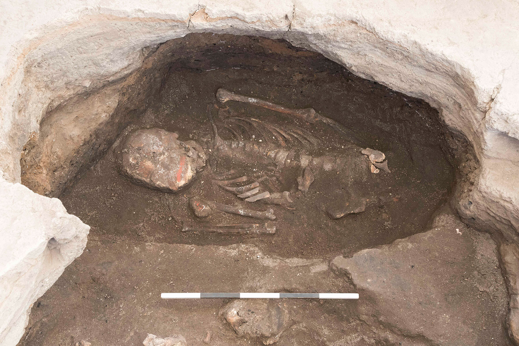 Examining the colored skeletons of Çatalhöyük