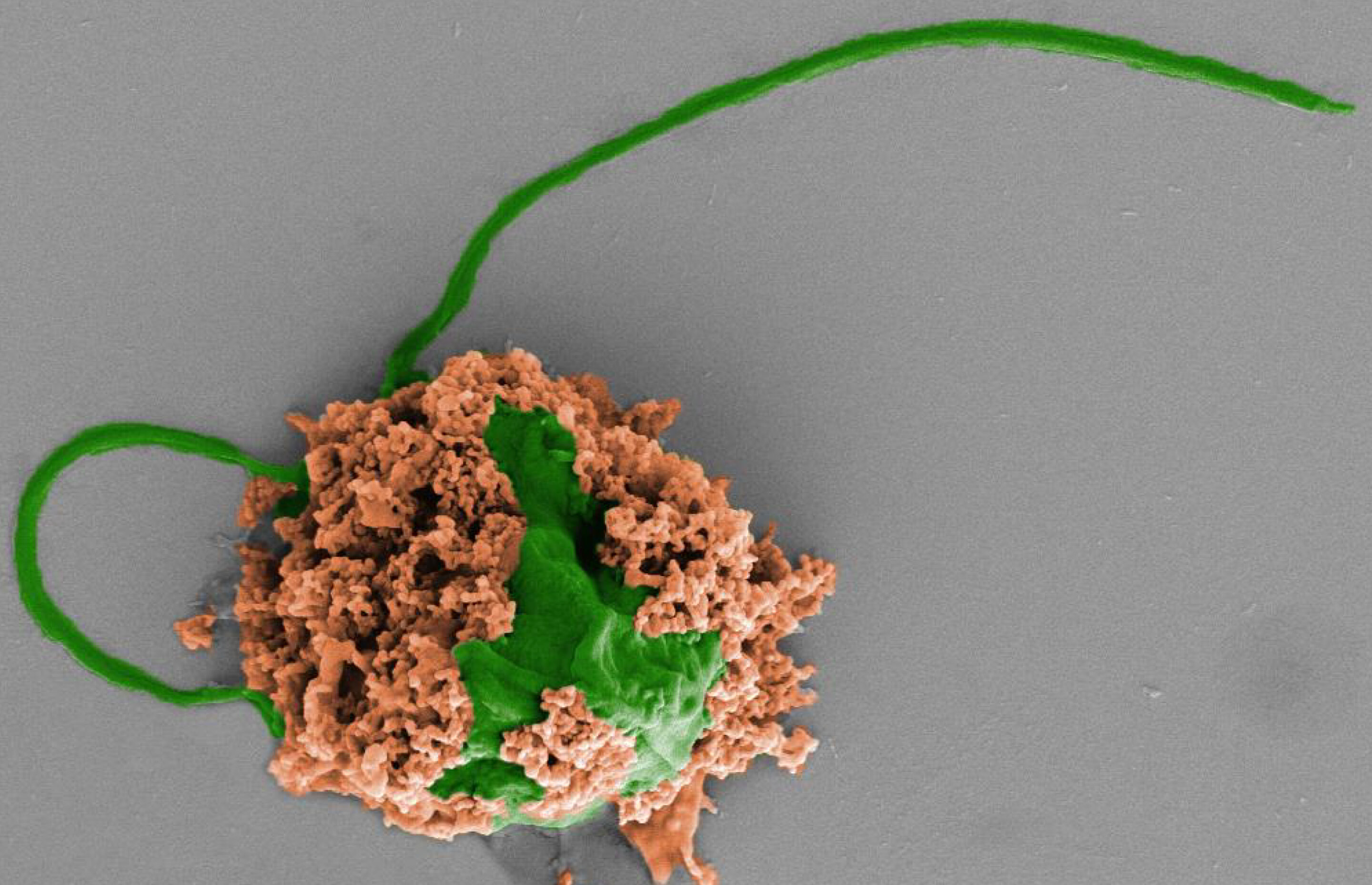 Swimming nanorobots treat deadly pneumonia in mice