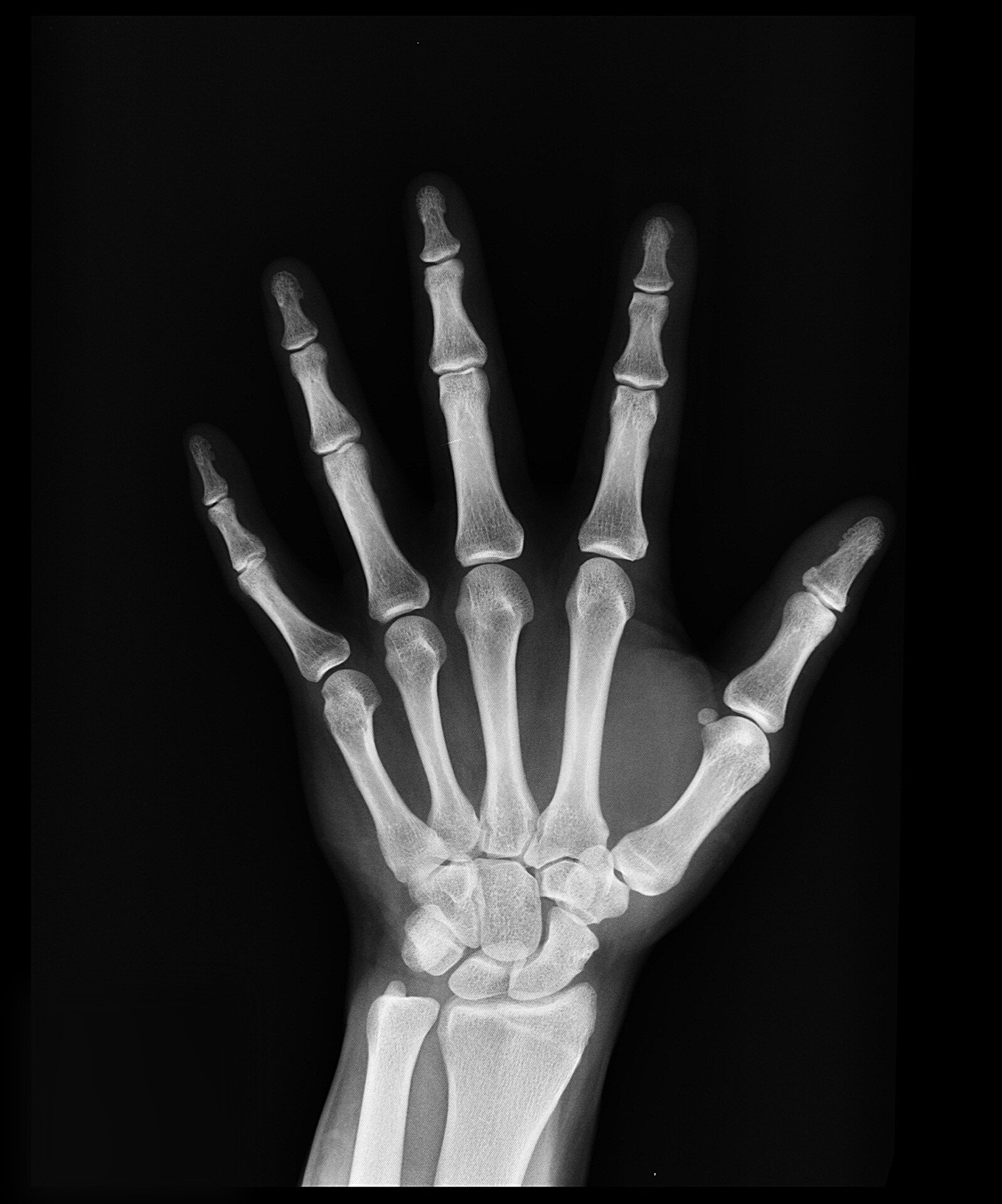 #Bone quality diagnostic tool could provide better insights into bone hardness