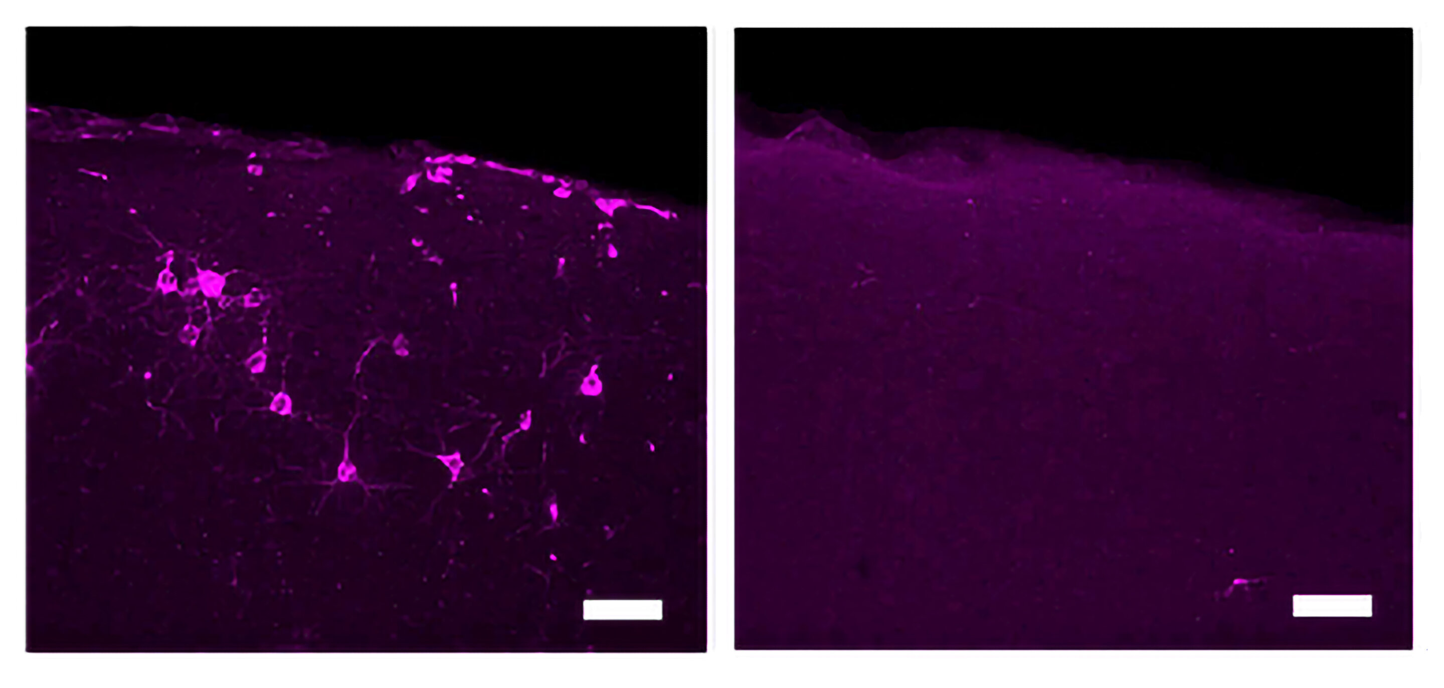 40 Hz vibrations reduce Alzheimer’s pathology, symptoms in mouse models