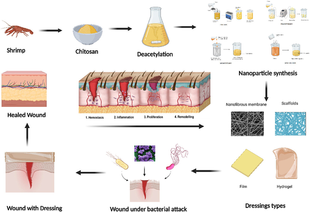 Read more about the article Developments in sustainable chitosan-based nanocomposites for wound dressings