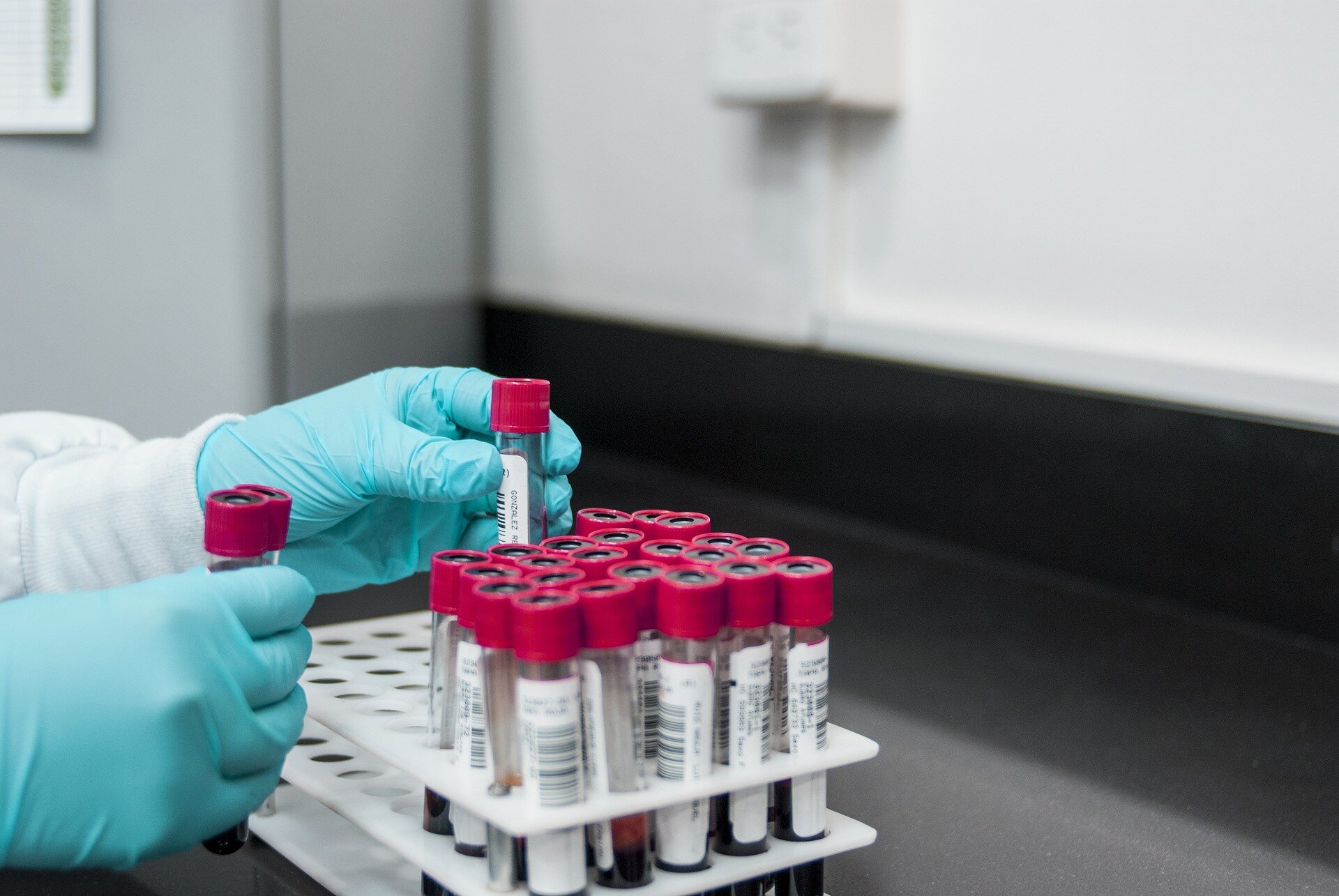 New blood test for stroke detection combines blood-based biomarkers with a clinical score