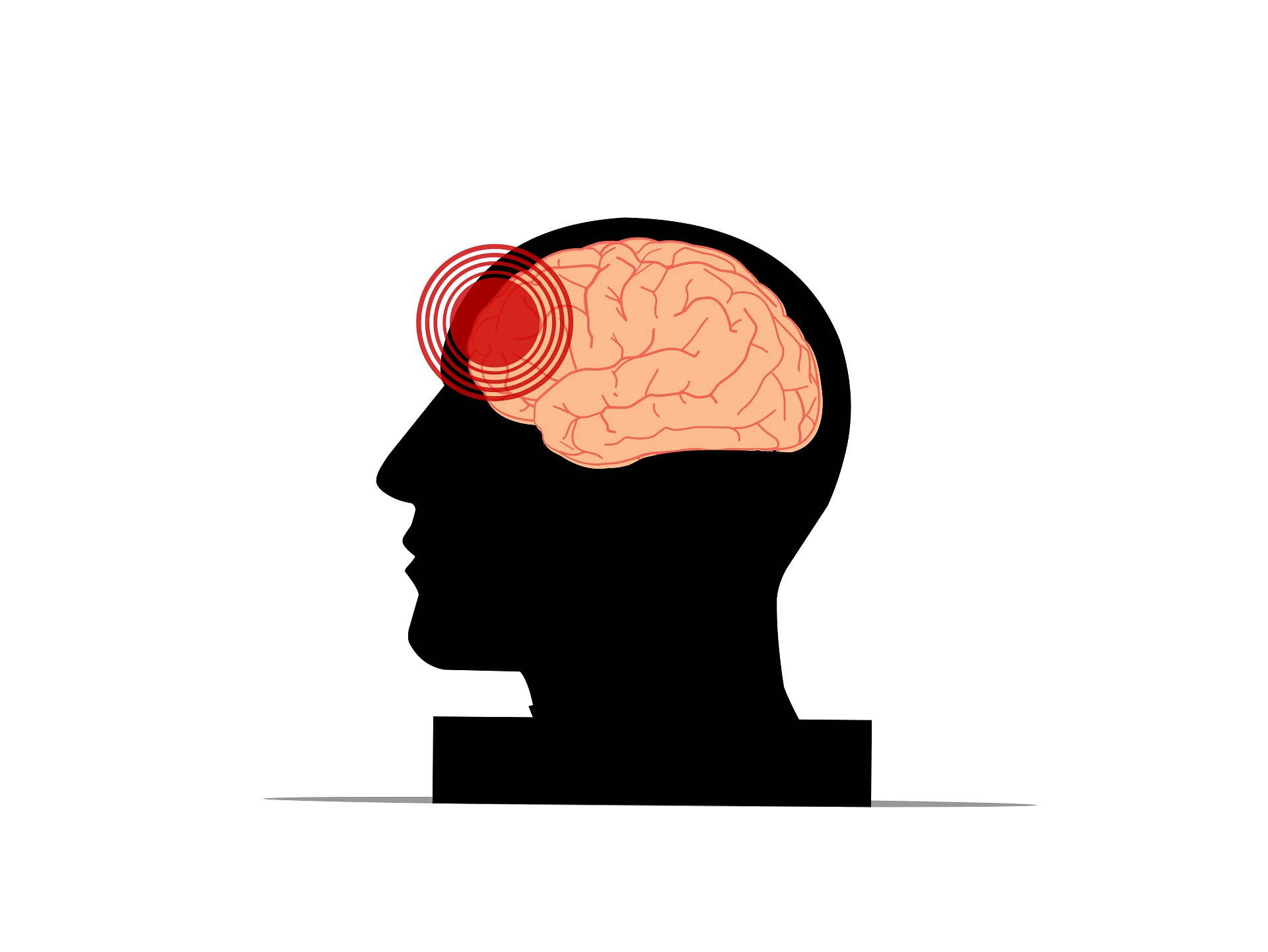 Brain injury. Мозг в голове. Травма головы вектор.