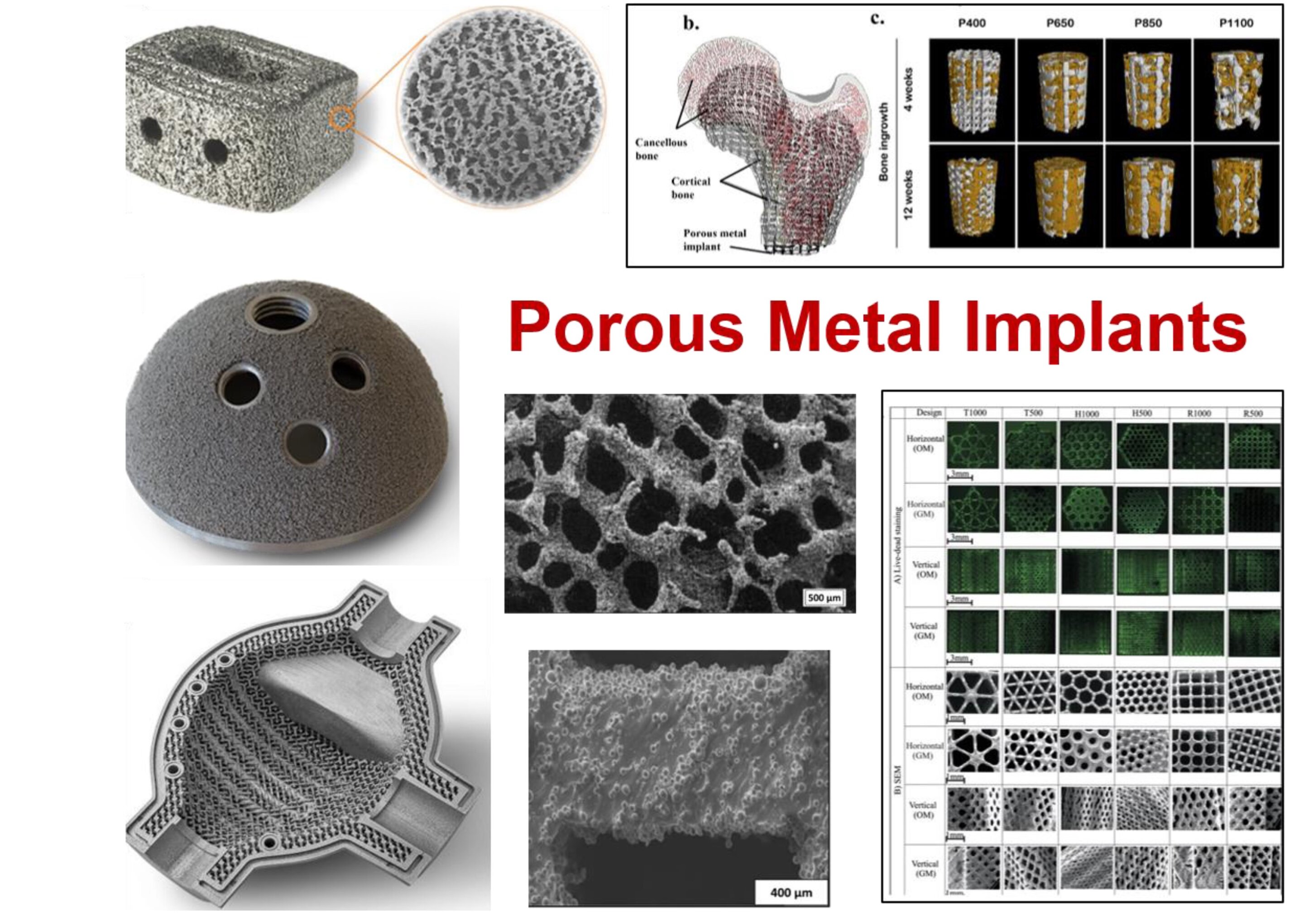 Exploring Porous Metals in Orthopedic Implants and Beyond: An Investigation