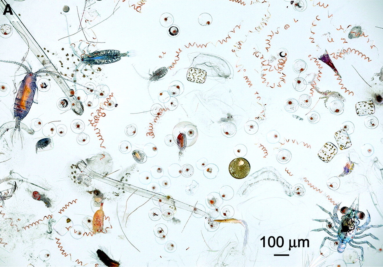 Marine plankton tell the long story of ocean health, and maybe human too