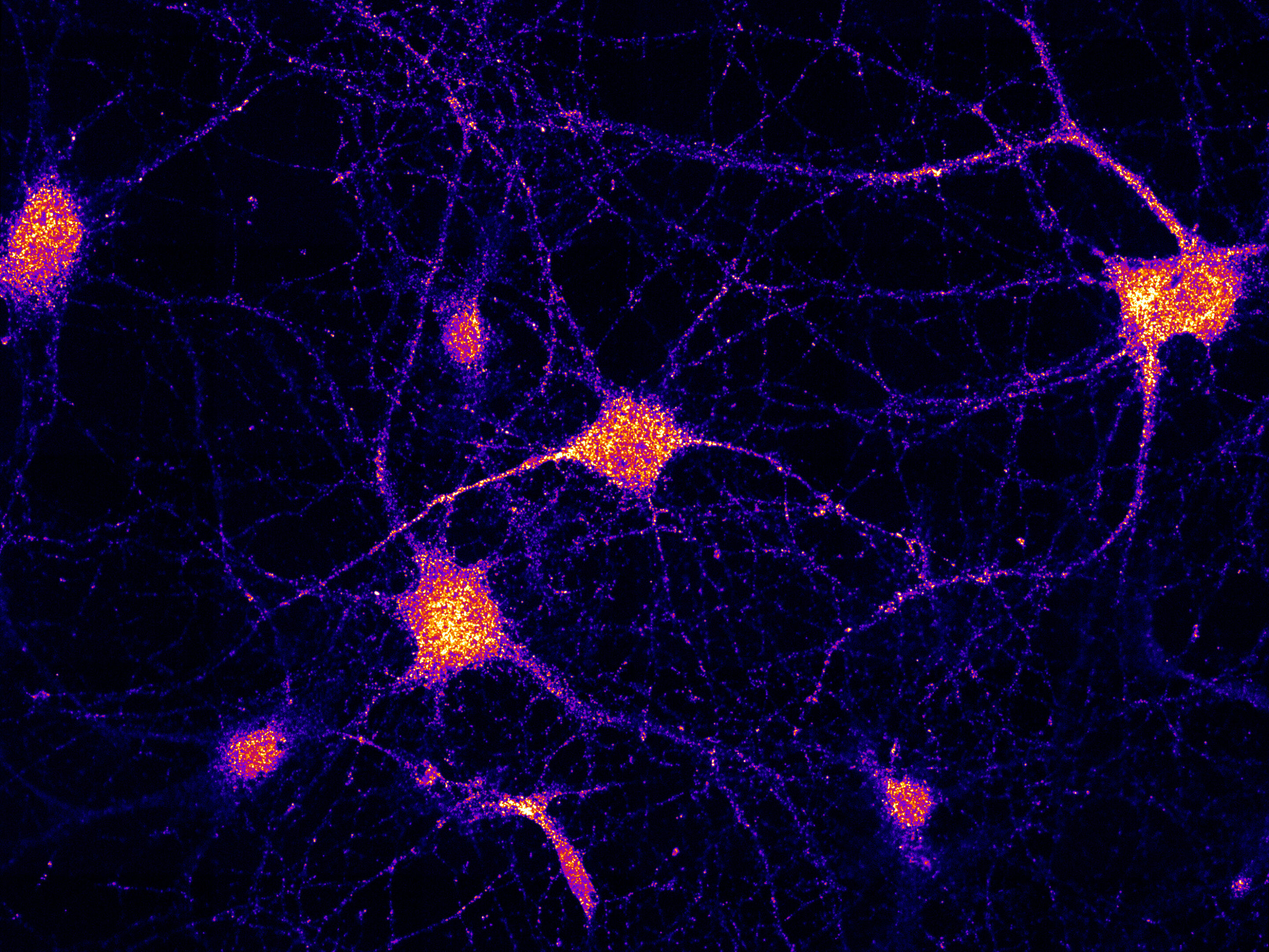 real neurons in the brain