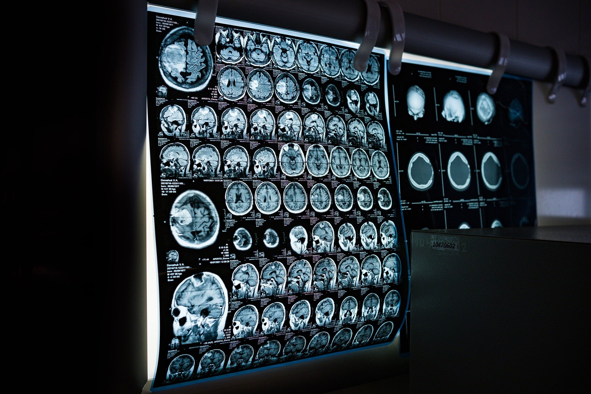 Researchers review use of MRI to identify brain cancer biomarkers
