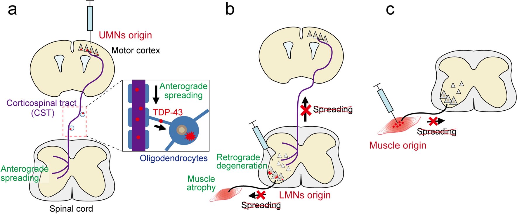 Neue Erkenntnisse zum proteinvermittelten Motoneuronenverlust bei amyotropher Lateralsklerose