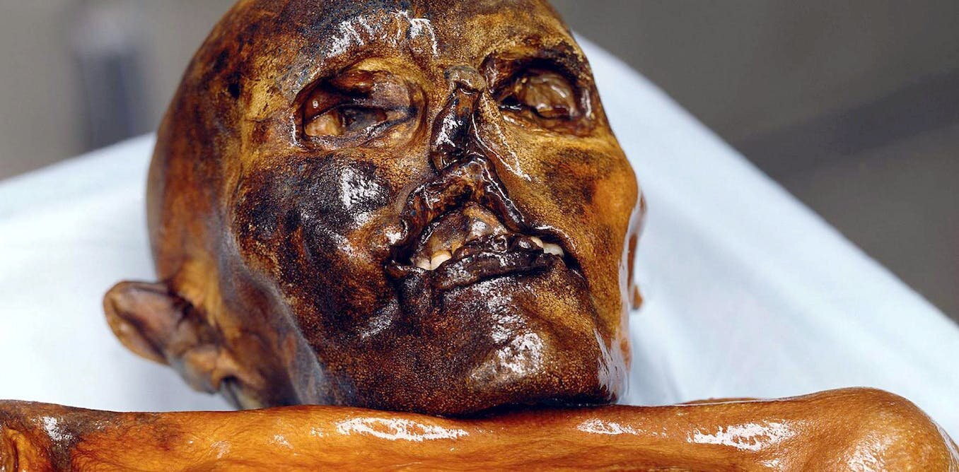 New Study Reveals Ötzi the Iceman's Ancestry and Male-Pattern Baldness