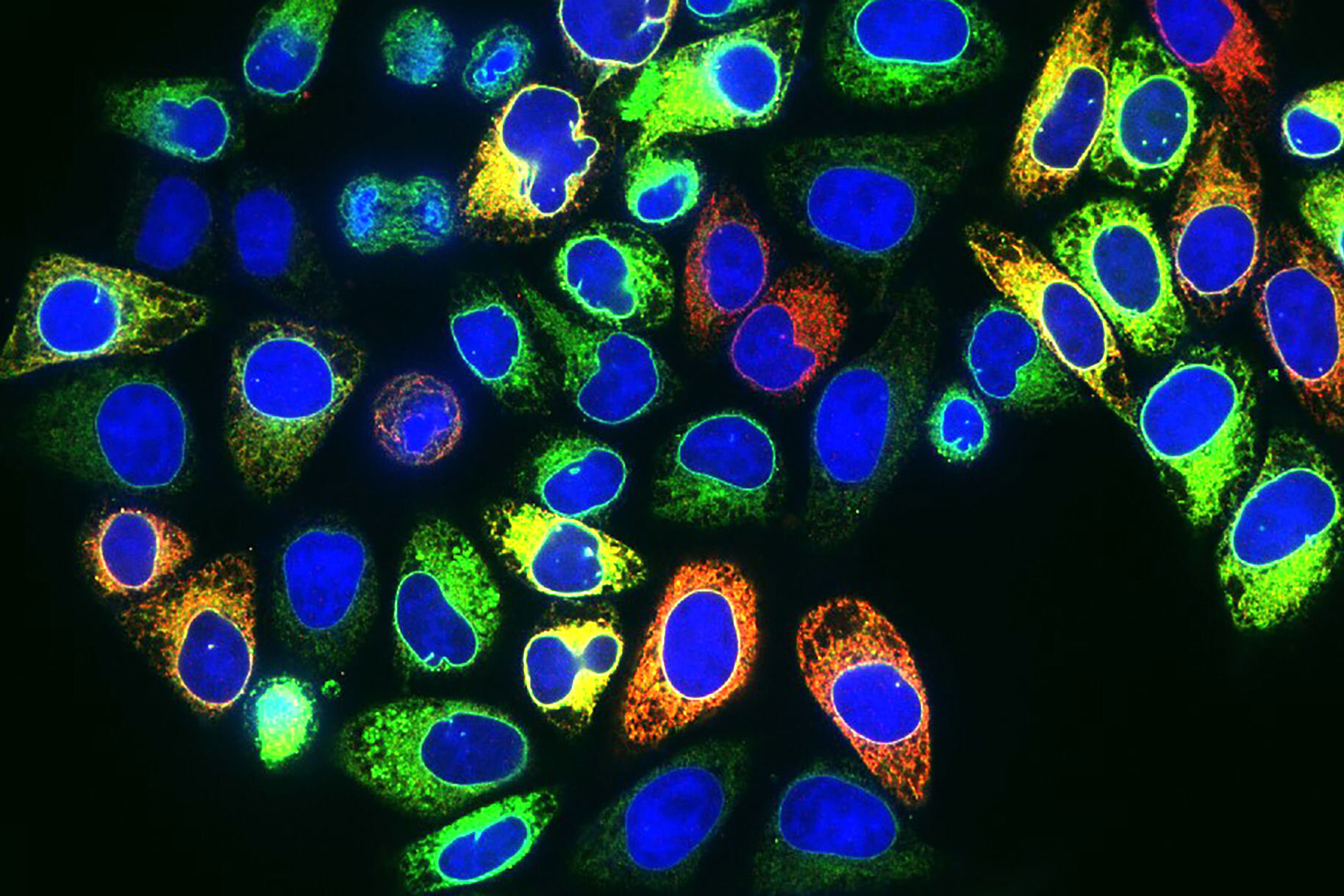 photo of Power of cancer drugs may see boost by targeting newly identified pathway image