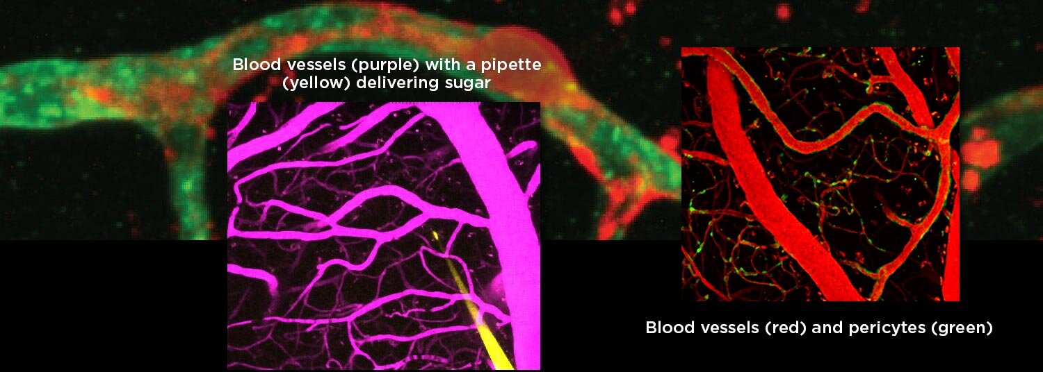 photo of Special vascular cells adjust blood flow in brain capillaries based on local energy needs image