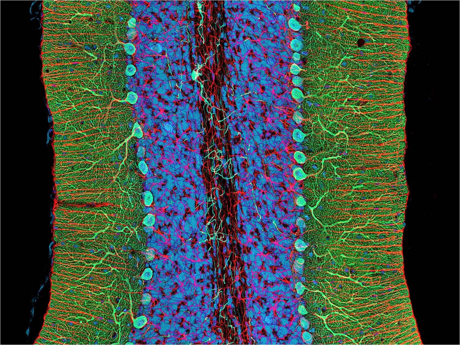 Слои клеток головного мозга. Микрофотографии гистология. Нейроны мозга под микроскопом. Клетки мозга под микроскопом. Ткань мозга под микроскопом.