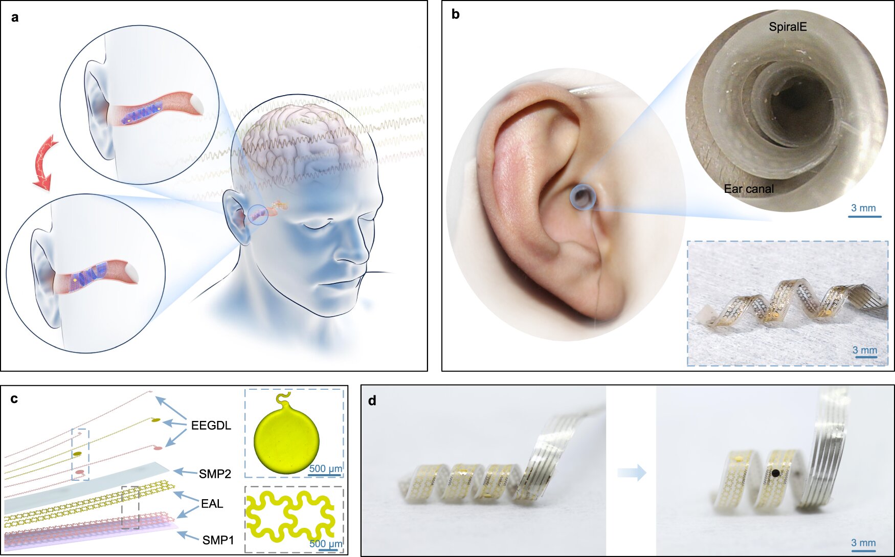 Interfejs spirala-mózg-komputer wsuwa się do kanału słuchowego bez utraty słuchu