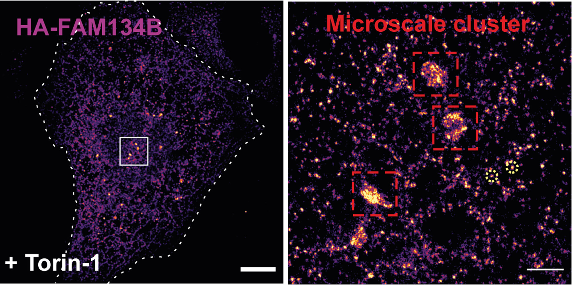 photo of When the cell digests itself: How inherited neurodegenerative diseases develop image