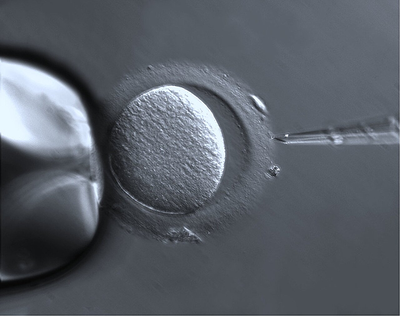 Analyzing the impact of ovulation-inducing agents on the quality of embryo