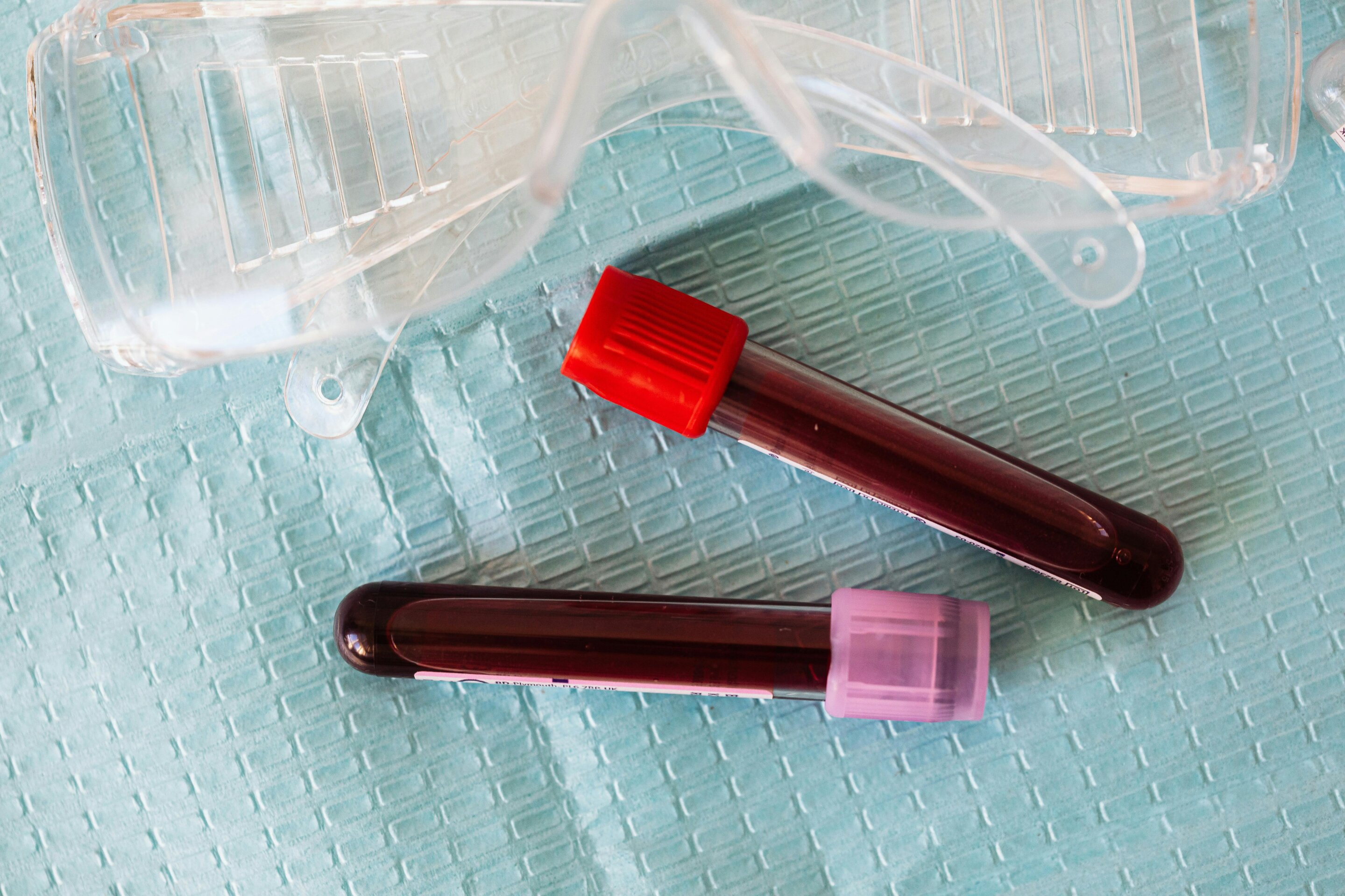 #Blood analysis predicts sepsis and organ failure in children