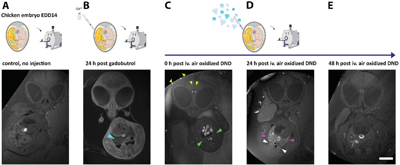 Diamond dust as a potential alternative to contrast agent gadolinium in magnetic resonance imaging