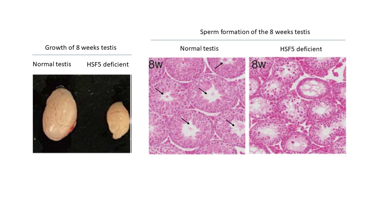 Discovery of an atypical heat shock factor, HSF5, involved in meiotic mechanisms has implications for male infertility