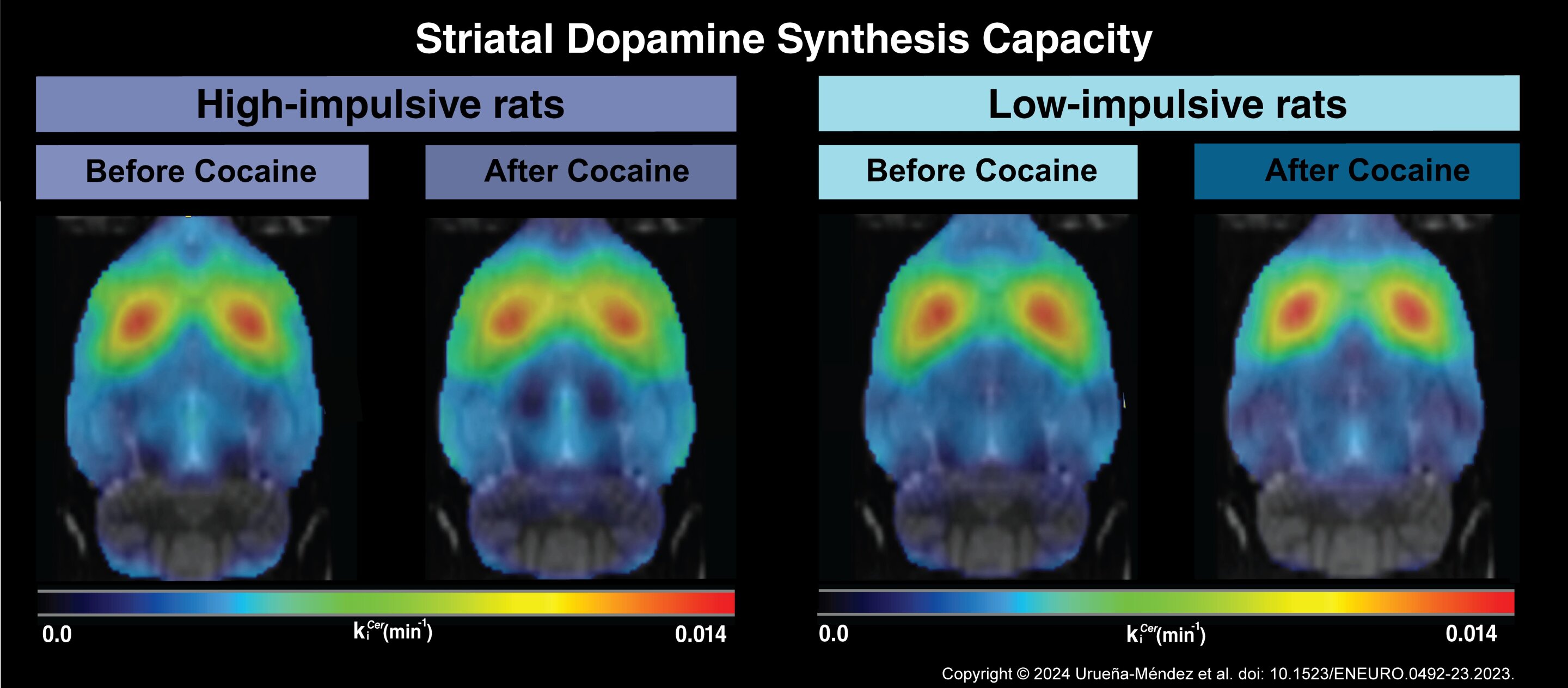 #Dopamine production is not behind vulnerability to cocaine abuse
