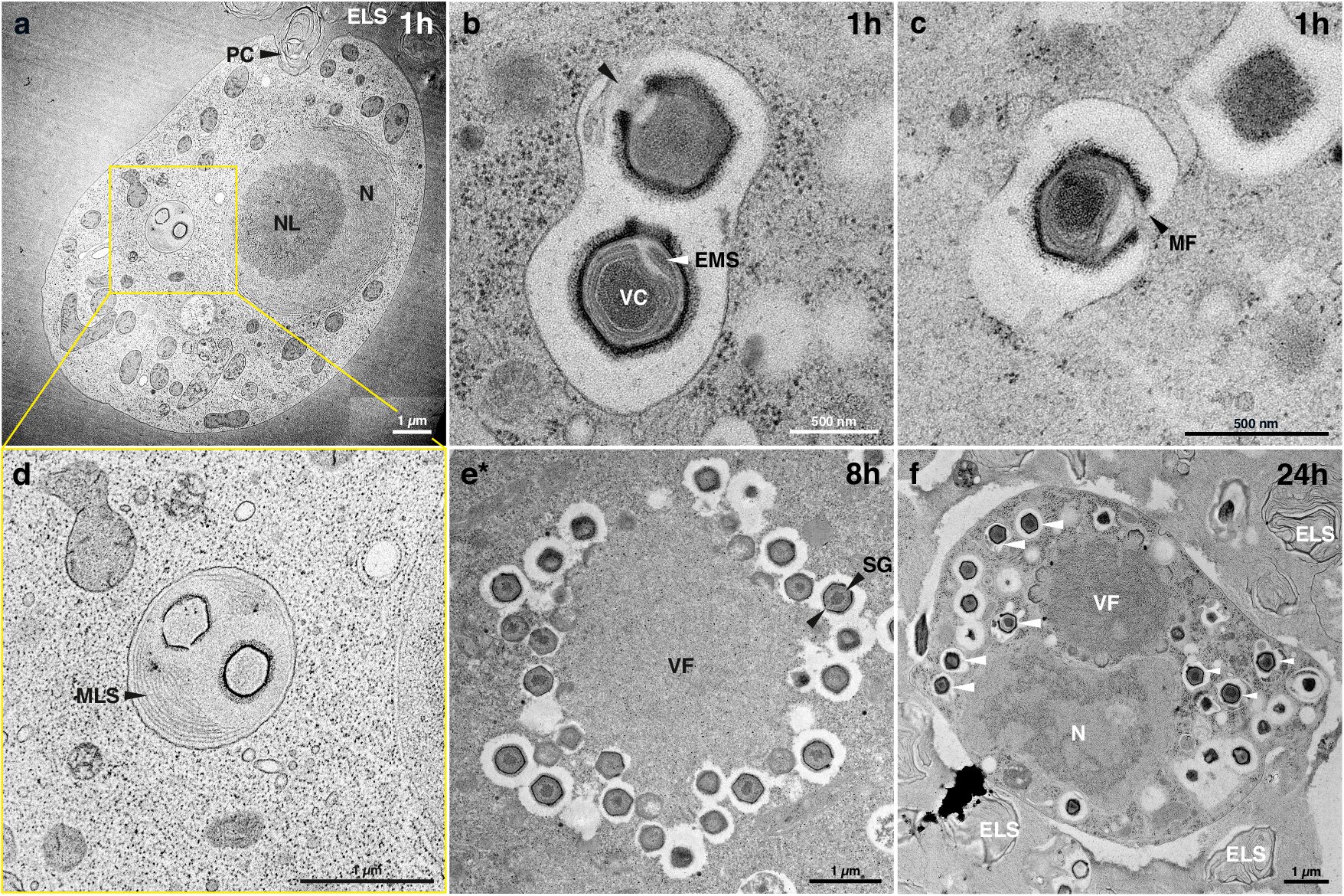 photo of Giant virus discovered in wastewater treatment plant infects deadly parasite image
